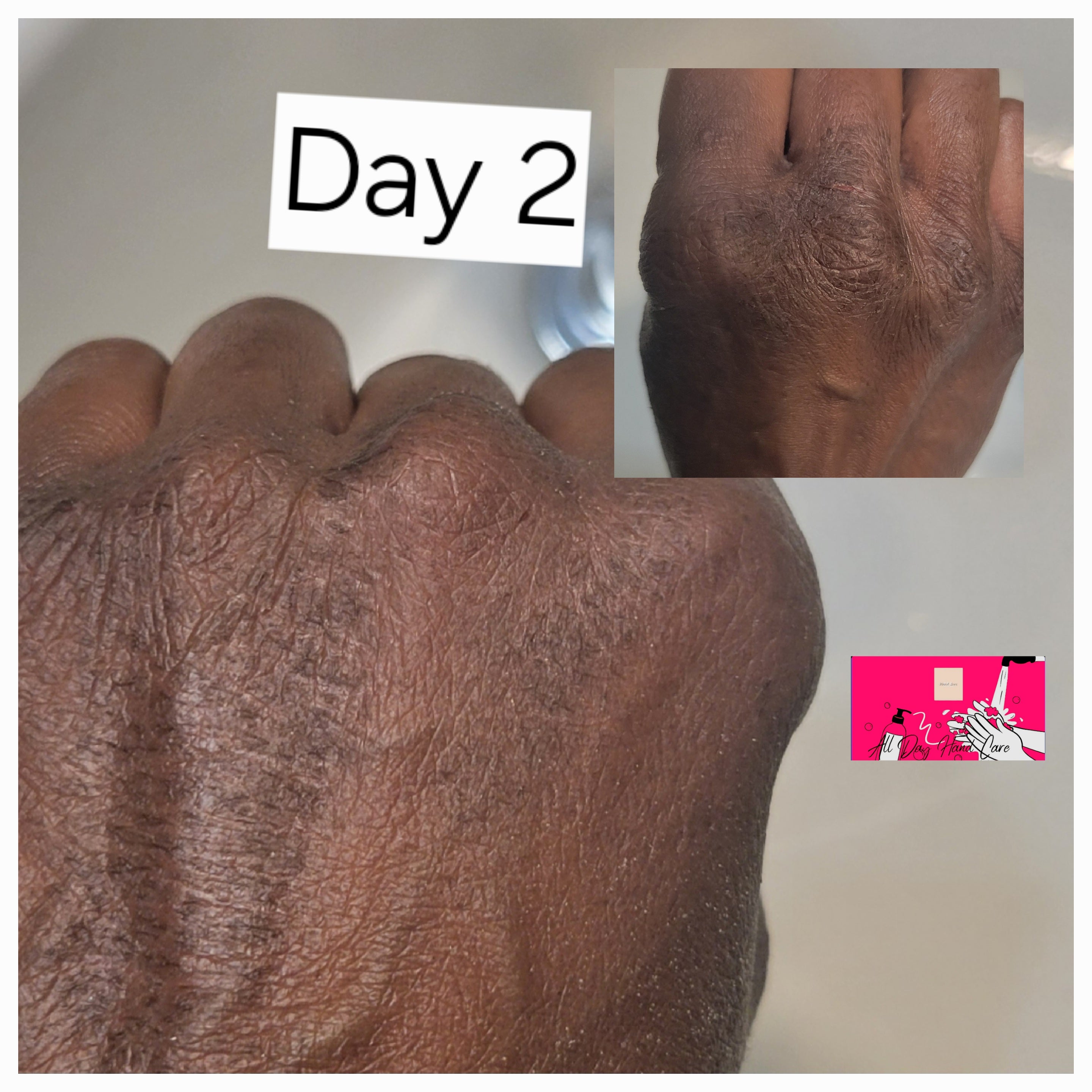 Barrier-Repair Hand Cream ✨